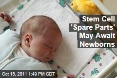 Stem Cell 'Spare Parts' May Await Newborns