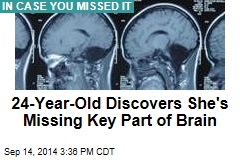 24-Year-Old Discovers She's Missing Key Part of Brain