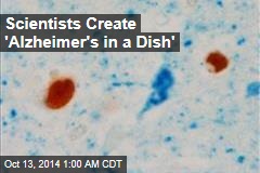 Scientists Create 'Alzheimer's in a Dish'